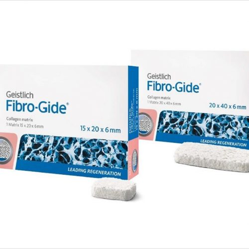 Fibro-Gide