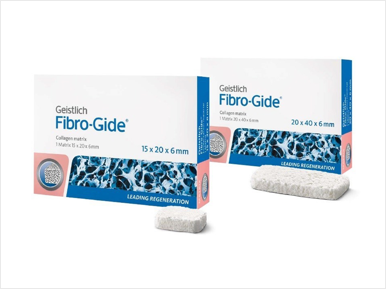 Fibro-Gide