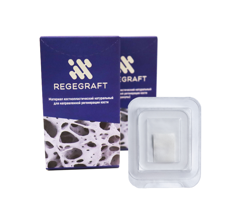 Regegraft Lamina