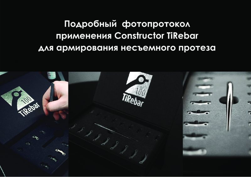 Презентация - фотопротокол использования TiRebar