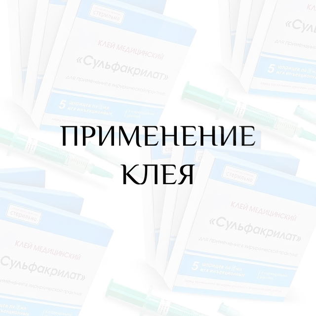 Применение клея