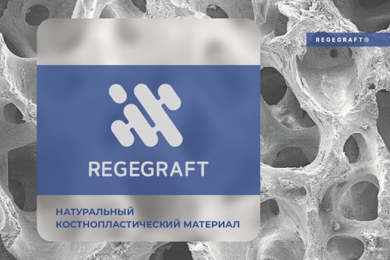 REGREGRAFT