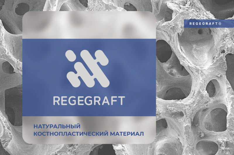 REGEGRAFT